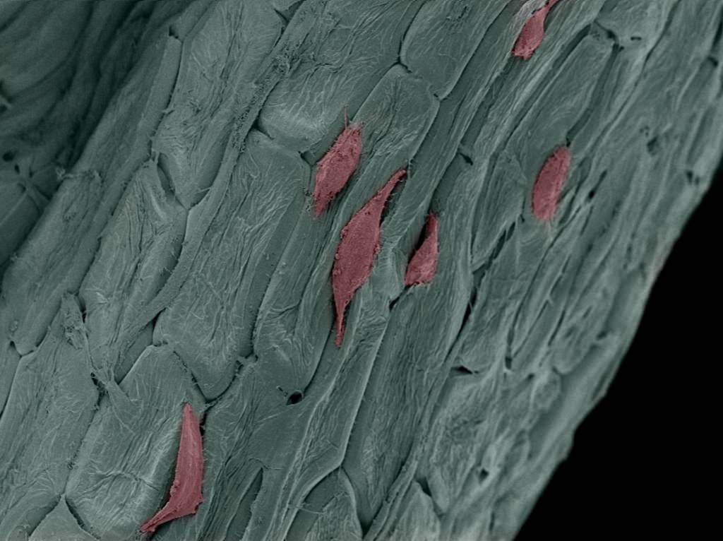 Parsley stem